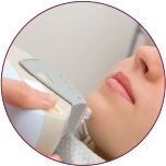 Acne Scar Treatment in indore