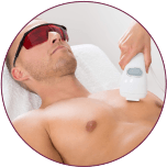 chest hair removal in indore