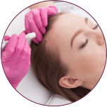 female hair transplant in indore