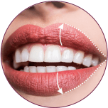 LIP REDUCTION in bhopal