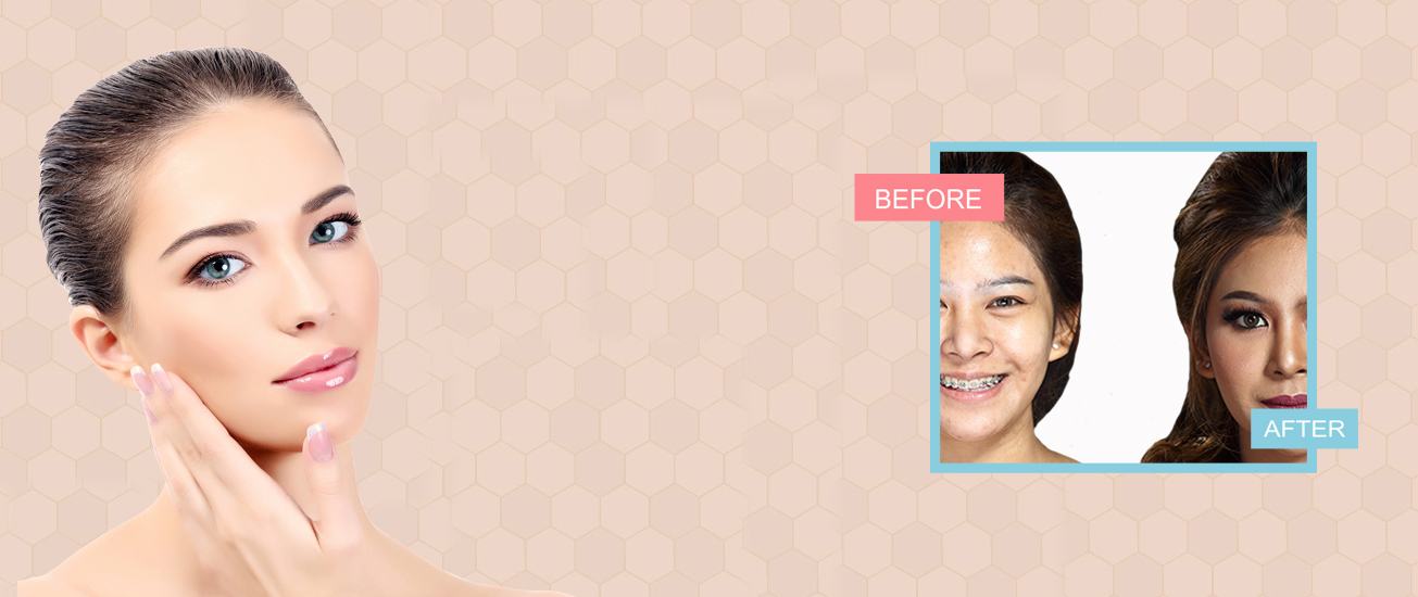 face surgery in indore marmm