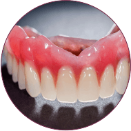 Dentures cost in indore