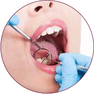 Root Canal in indore